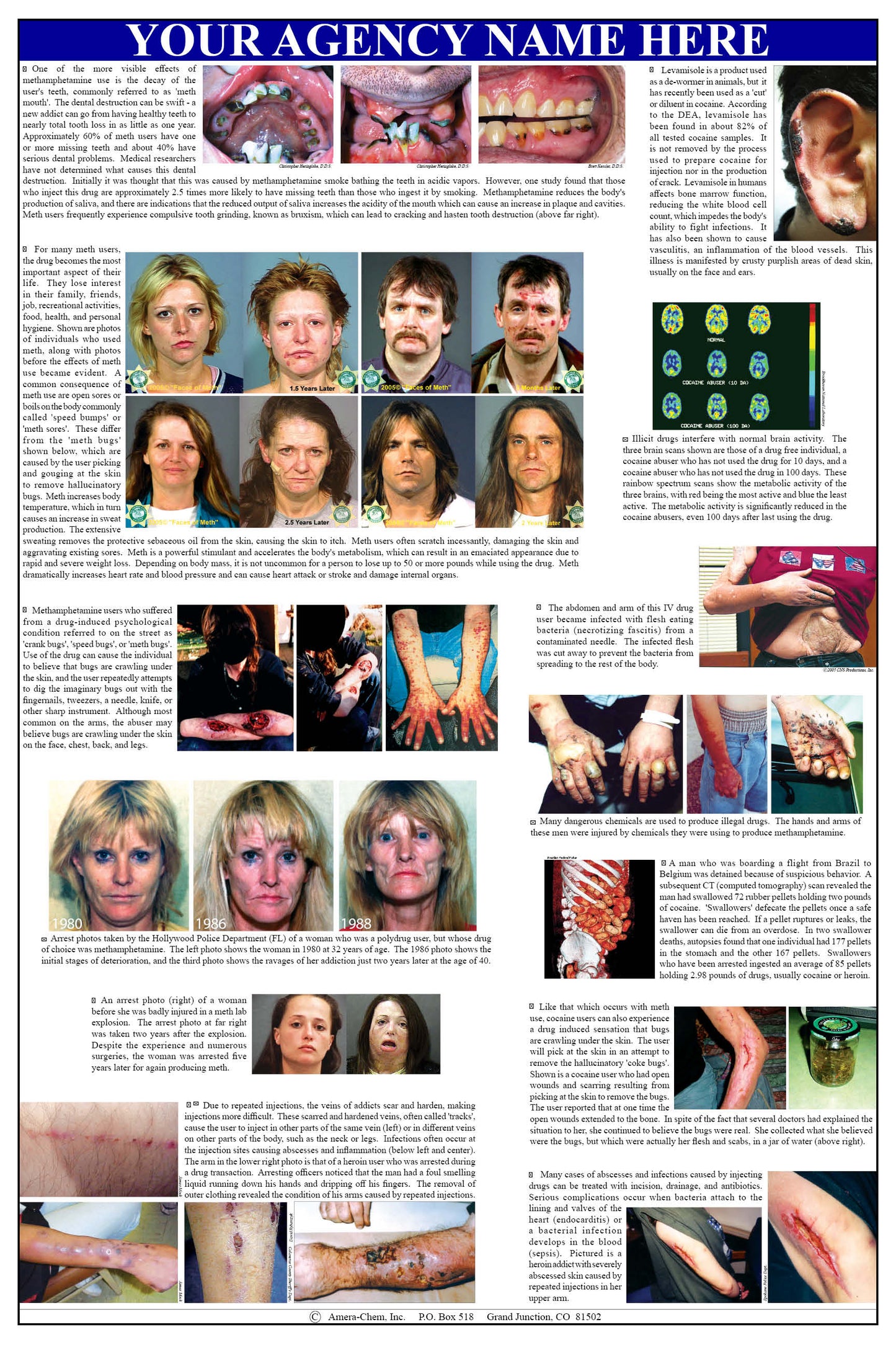 A Body on Drugs Wall Chart