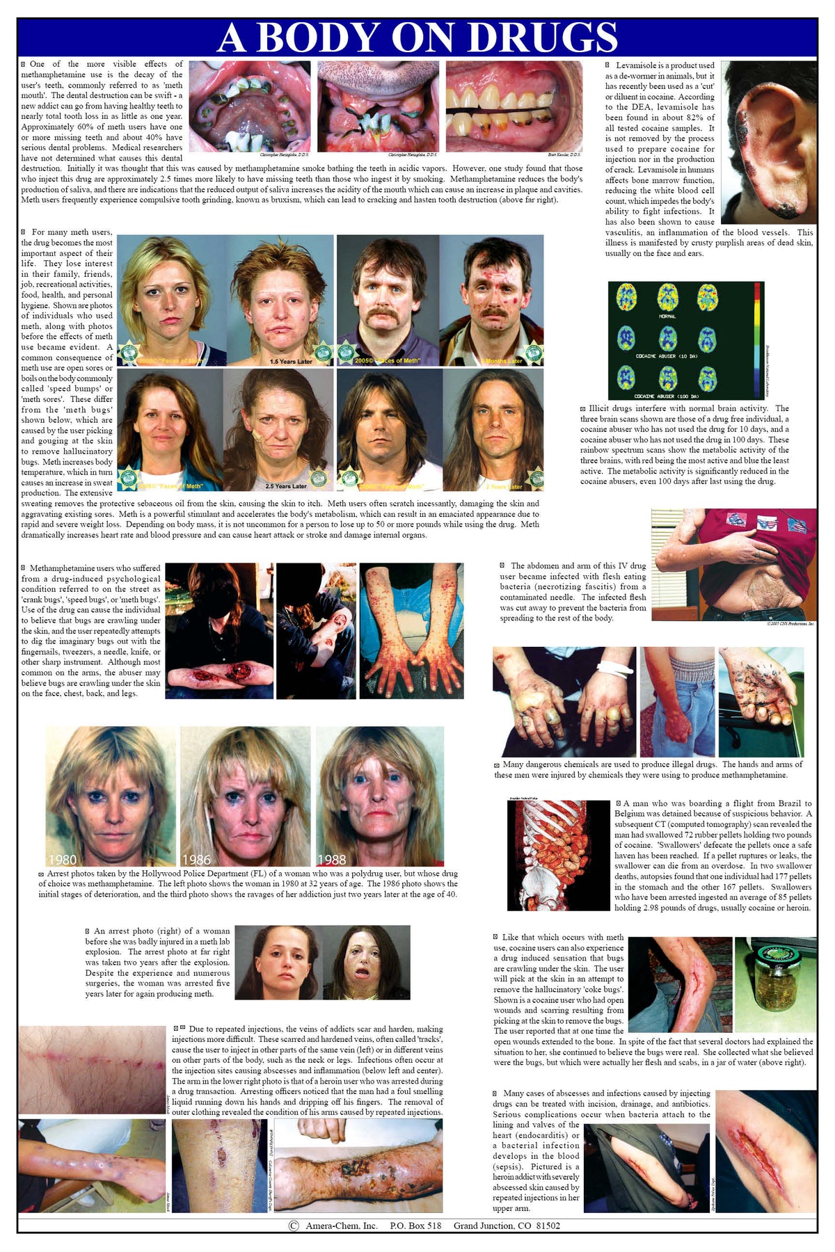 Body Chart Medication A Body on Drugs Wall Chart – Amera-Chem, Inc./Drug Identification Bible